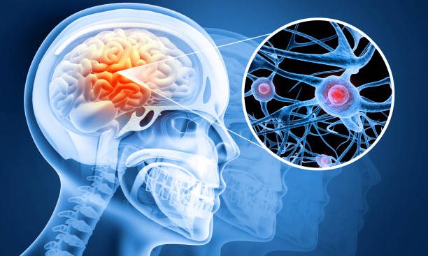 Human brain damage and treatment concept. 3d illustration